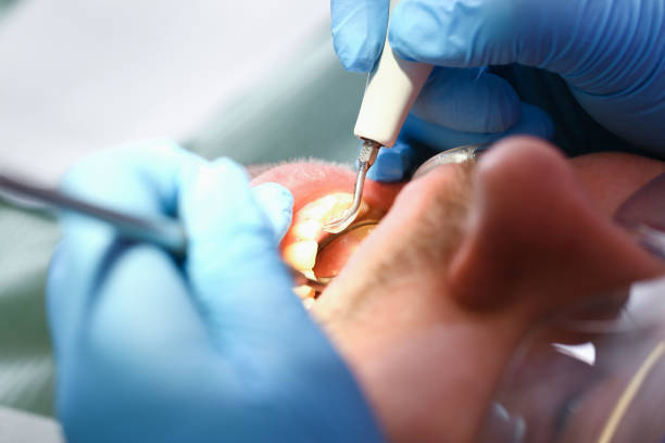 Best Walk-In Emergency Dentist in Hiram, OH