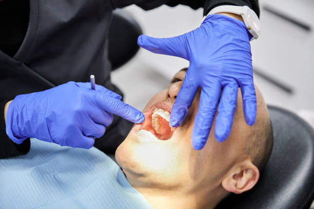 Best Emergency Broken Tooth Repair in Hiram, OH